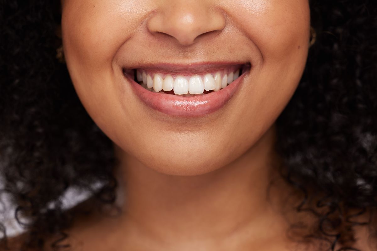 teeth-whitening-cosmetic-dentist-hewlett-ny