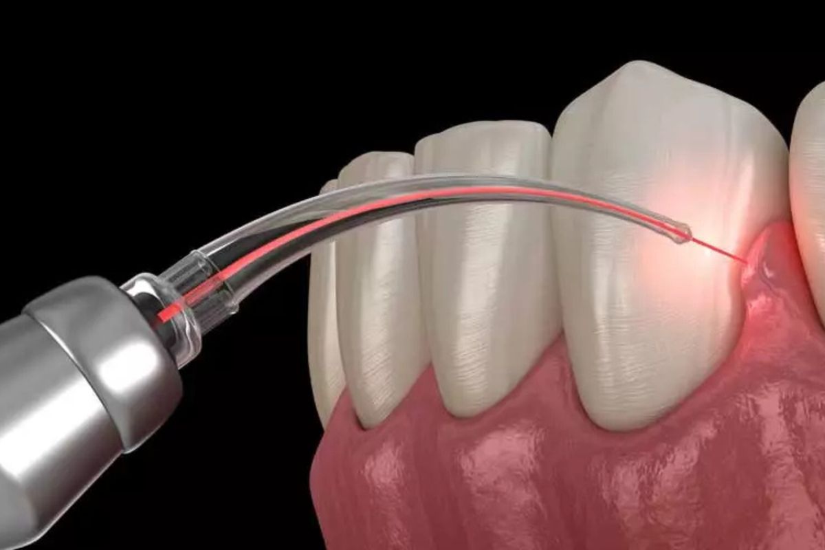 how-do-dentists-diagnose-gum-disease